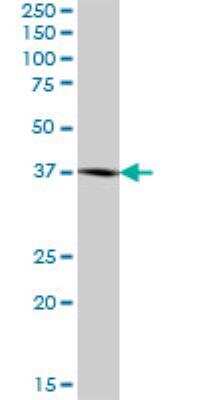 Western Blot: BCAT2 Antibody [H00000587-B01P]