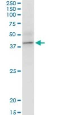 Western Blot: BCAT2 Antibody [H00000587-B01P]