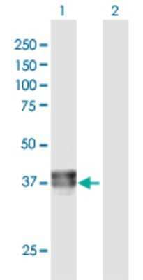 Western Blot: BCAT2 Antibody [H00000587-D01P]