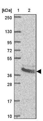 Western Blot: BCAT2 Antibody [NBP2-33705]