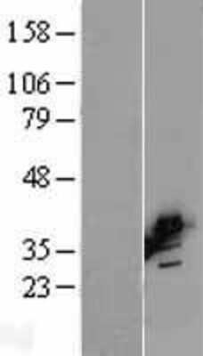 Western Blot: BCAT2 Overexpression Lysate [NBP2-04193]