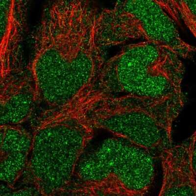 Immunocytochemistry/ Immunofluorescence: BCCIP Antibody [NBP2-55218]