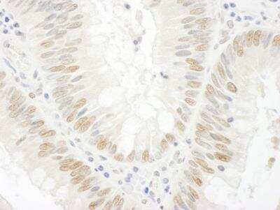 Immunohistochemistry: BCCIP Antibody [NBP1-22994]