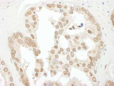 Immunohistochemistry-Paraffin: BCCIP Antibody [NBP1-22994]