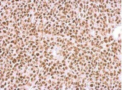 Immunohistochemistry-Paraffin: BCCIP Antibody [NBP1-31319]