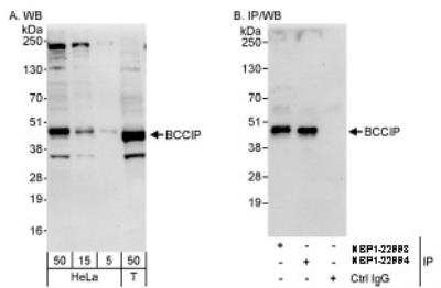 Western Blot: BCCIP Antibody [NBP1-22993]