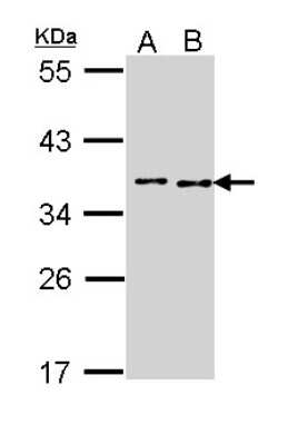 Western Blot: BCCIP Antibody [NBP1-31319]