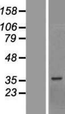 Western Blot: BCCIP Overexpression Lysate [NBP2-07002]