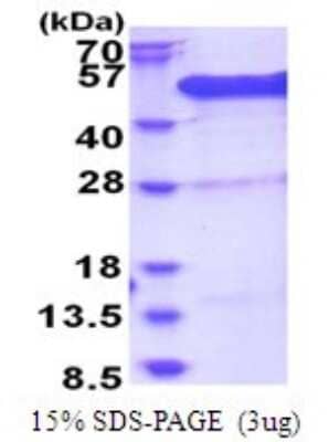 SDS-PAGE: Recombinant Human BCCIP His Protein [NBP2-51760]