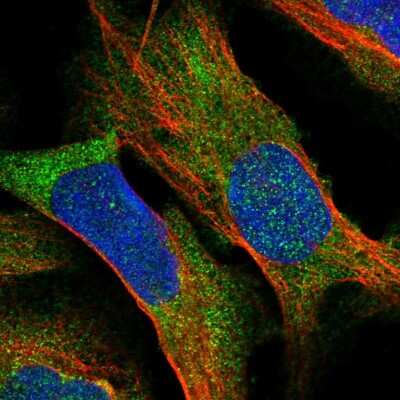 Immunocytochemistry/ Immunofluorescence: BCDIN3D Antibody [NBP1-85857]