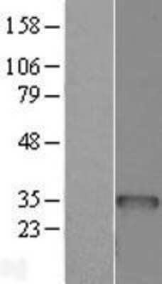 Western Blot: BCDIN3D Overexpression Lysate [NBL1-07941]