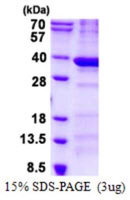 SDS-PAGE: Recombinant Human BCDIN3D His Protein [NBP2-22706]