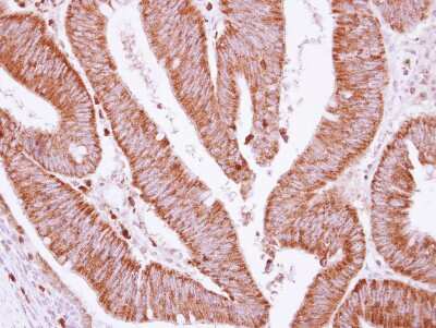 Immunohistochemistry-Paraffin: BCKDHA Antibody [NBP2-15552]