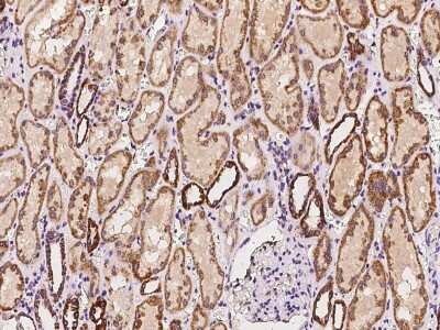 Immunohistochemistry-Paraffin: BCKDHA Antibody [NBP2-97503]