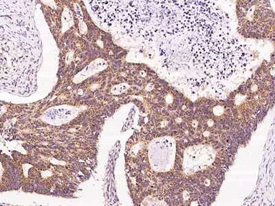 Immunohistochemistry-Paraffin: BCKDHA Antibody [NBP2-97503]