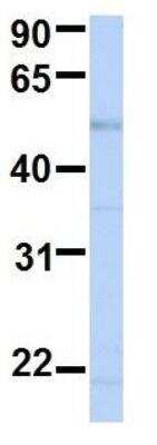 Western Blot: BCKDHA Antibody [NBP1-79616]