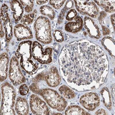 Immunohistochemistry-Paraffin: BCKDHB Antibody [NBP1-86326]