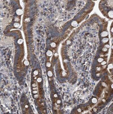 Immunohistochemistry-Paraffin: BCKDHB Antibody [NBP1-86326]