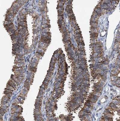 Immunohistochemistry-Paraffin: BCKDHB Antibody [NBP1-86326]