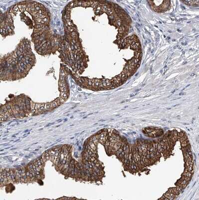 Immunohistochemistry-Paraffin: BCKDHB Antibody [NBP1-86326]