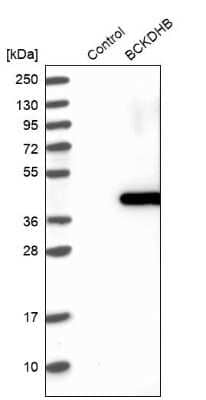 Western Blot: BCKDHB Antibody [NBP1-86326]