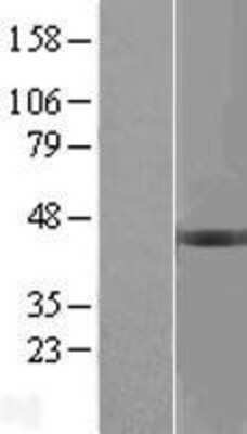 Western Blot: BCKDHB Overexpression Lysate [NBL1-07943]