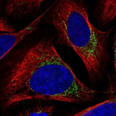 Immunocytochemistry/ Immunofluorescence: BCKDK Antibody [NBP2-54937]