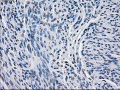 Immunohistochemistry: BCKDK Antibody (OTI11C9) - Azide and BSA Free [NBP2-71573]