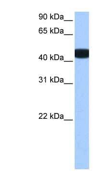 Western Blot: BCKDK Antibody [NBP1-57574]