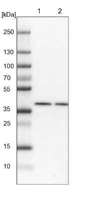 Western Blot: BCKDK Antibody [NBP1-86052]