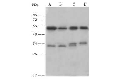 Western Blot: BCKDK Antibody [NBP2-99564]