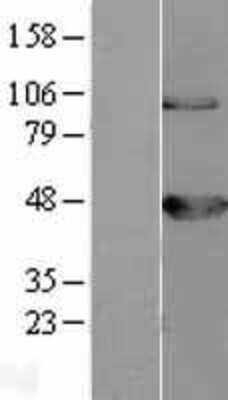 Western Blot: BCKDK Overexpression Lysate [NBL1-07945]