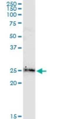 Western Blot: BCL-W/BCL2L2 Antibody (2E4) [H00000599-M01]