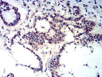 Immunohistochemistry-Paraffin: BCL11B Antibody (1F8G8) - BSA Free [NBP2-61702]