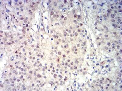 Immunohistochemistry-Paraffin: BCL11B Antibody (1F8G8) - BSA Free [NBP2-61702]