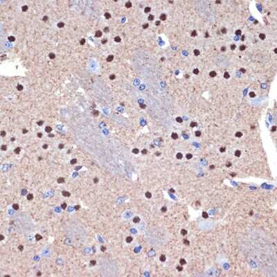 Immunohistochemistry-Paraffin: BCL11B Antibody (9C1B6) [NBP3-15927]
