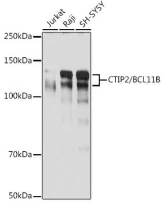 Western Blot: BCL11B Antibody (9C1B6) [NBP3-15927]