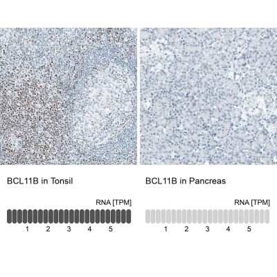 Immunohistochemistry-Paraffin: BCL11B Antibody (CL6426) [NBP2-76493]
