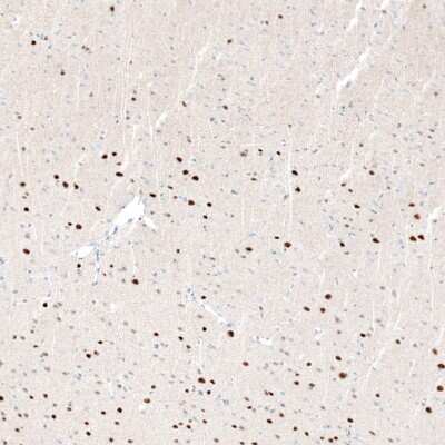 Immunohistochemistry-Paraffin: BCL11B Antibody (CL6426) [NBP2-76493]