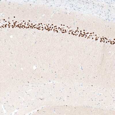 Immunohistochemistry-Paraffin: BCL11B Antibody (CL6426) [NBP2-76493]