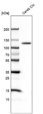 Western Blot: BCL11B Antibody (CL6426) [NBP2-76493]