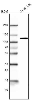 Western Blot: BCL11B Antibody (CL6426) [NBP2-76493]