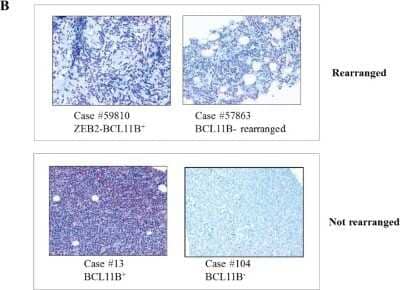 Immunohistochemistry: BCL11B Antibody [NB100-2600]