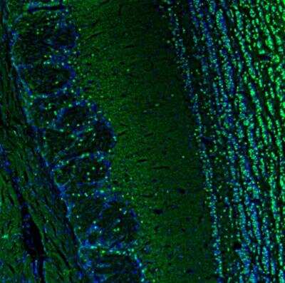 Immunohistochemistry: BCL11B Antibody [NBP2-33549]