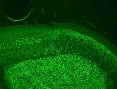 Immunohistochemistry-Paraffin: BCL11B Antibody [NB100-2600]