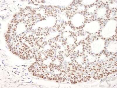 Immunohistochemistry-Paraffin: BCL11B Antibody [NB100-2600]