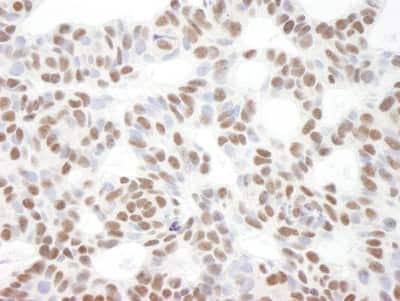 Immunohistochemistry-Paraffin: BCL11B Antibody [NB100-2600]