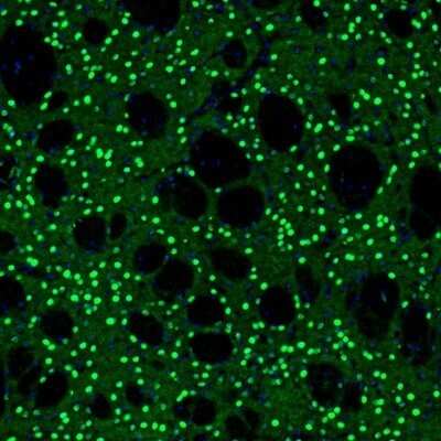 Immunohistochemistry: BCL11B Antibody [NBP2-33549]