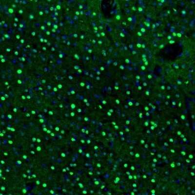 Immunohistochemistry: BCL11B Antibody [NBP2-33549]