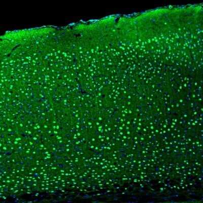 Immunohistochemistry: BCL11B Antibody [NBP2-33549]